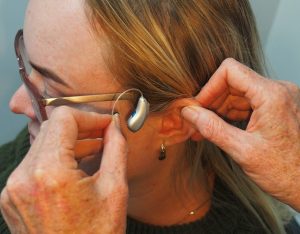 Over The Counter & Direct to Consumer Hearing Aids